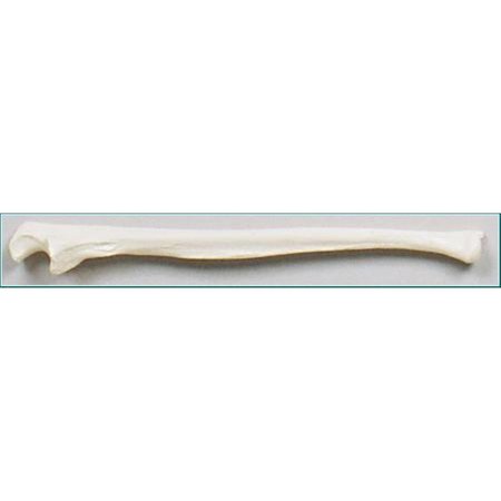 DENOYER-GEPPERT Anatomical Model, Ulna Bone (Right Side) SB34-D